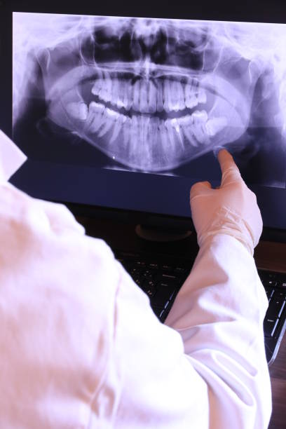Best Emergency Tooth Extraction in Bridgeport, AL